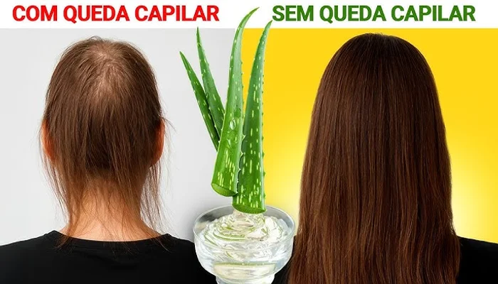 como fazer óleo de aloe vera para acelerar o crescimento do cabelo